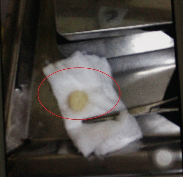 Sở Y tế Hà Nội vào cuộc vụ bé 2 tuổi tử vong do hóc kẹo ảnh 1