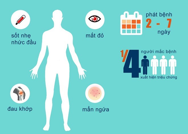 Vì sao Zika có khả năng lây lan nhanh ở Việt Nam? ảnh 2