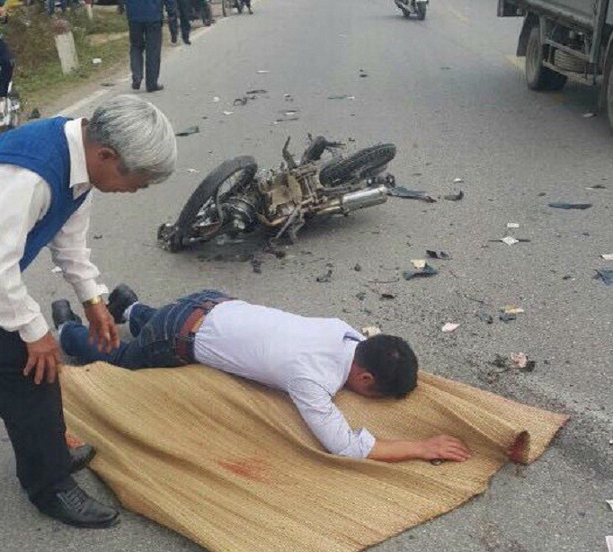 Nạn nhân đắp chiếu ‘sống lại’ phải cưa tay, cưa chân ảnh 2