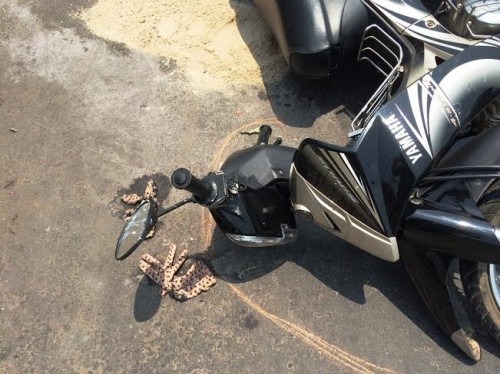 Vụ 2 nữ sinh bị tạt axit: Nạn nhân bỏng 75% mặt, mù 1 mắt ảnh 3