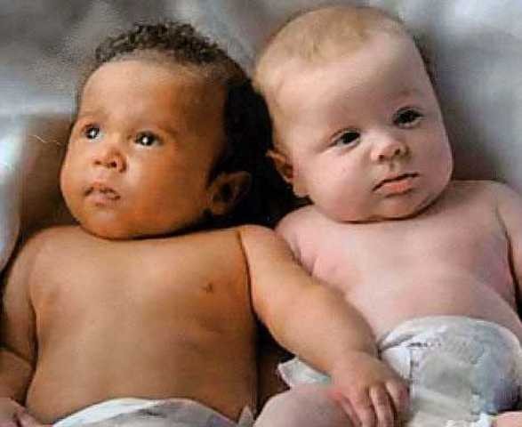 Cặp song sinh khác cha ở Hòa Bình: Có thể quan hệ kiểu 'tập thể' ảnh 1