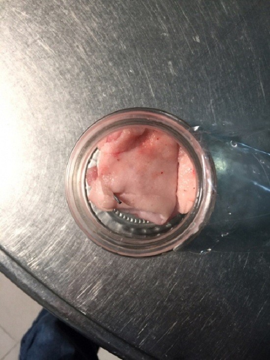 Phát hiện kim tiêm trong thịt lợn khi chế biến đồ ăn cho học sinh ảnh 1