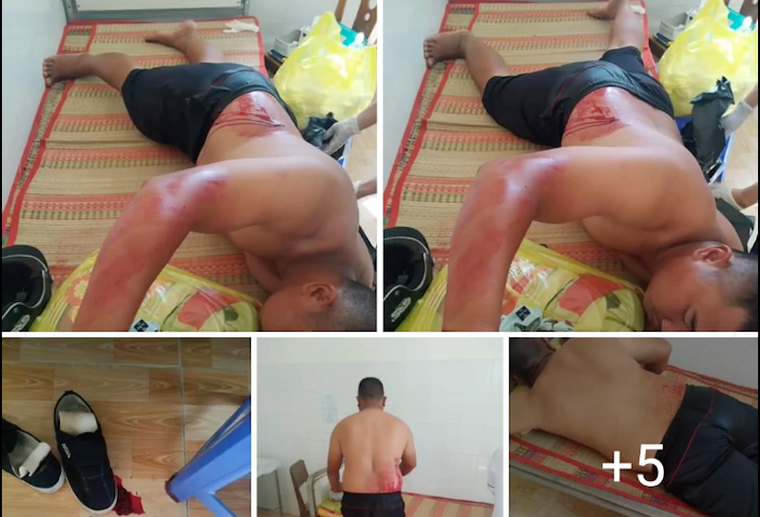 Một gia đình ở Ninh Thuận liên tục bị đánh, chém – Bài 1: Lời kêu cứu trong vô vọng ảnh 2