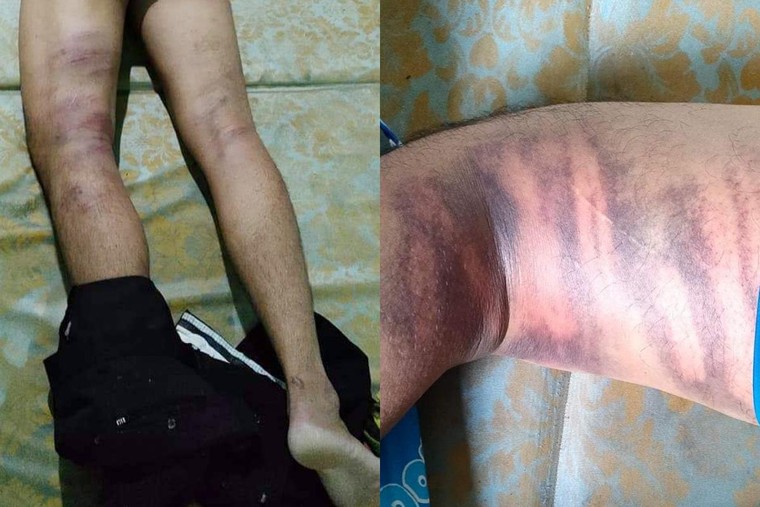 Vụ lực lượng kiểm soát dịch đánh dân: Bí thư Đồng Nai chỉ đạo xử lý, chấn chỉnh ảnh 1