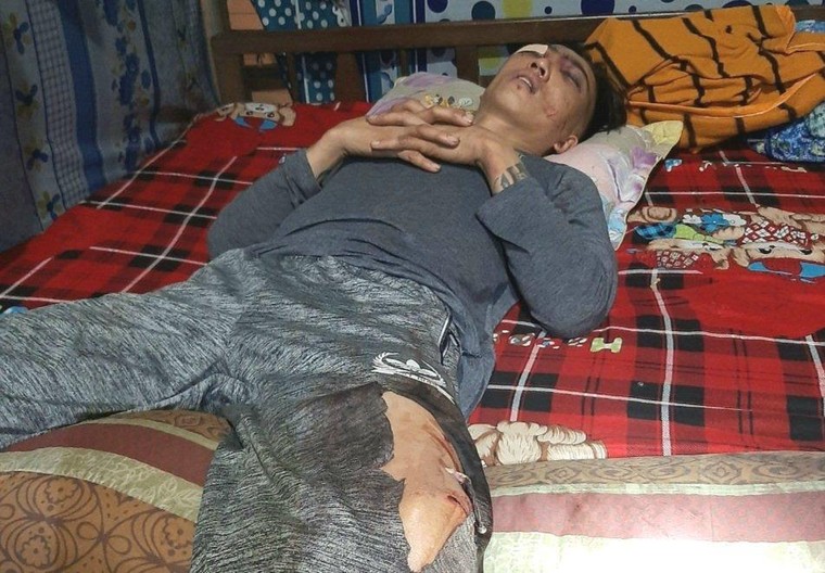 Đồng Nai: Nam thanh niên được nhận 50 triệu sau khi bị đánh nằm liệt giường ảnh 1