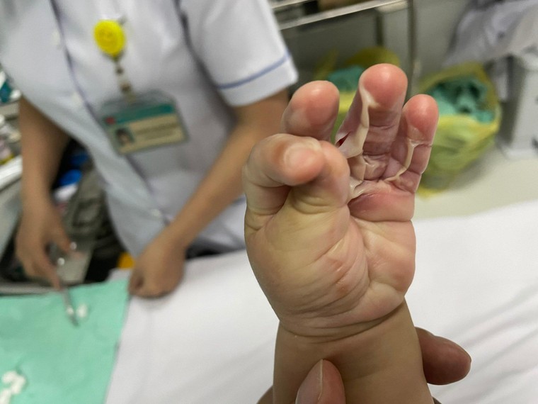 Bệnh nhân diễn tiến nặng, Bệnh viện FV khẳng định ‘đúng quy trình’? ảnh 2