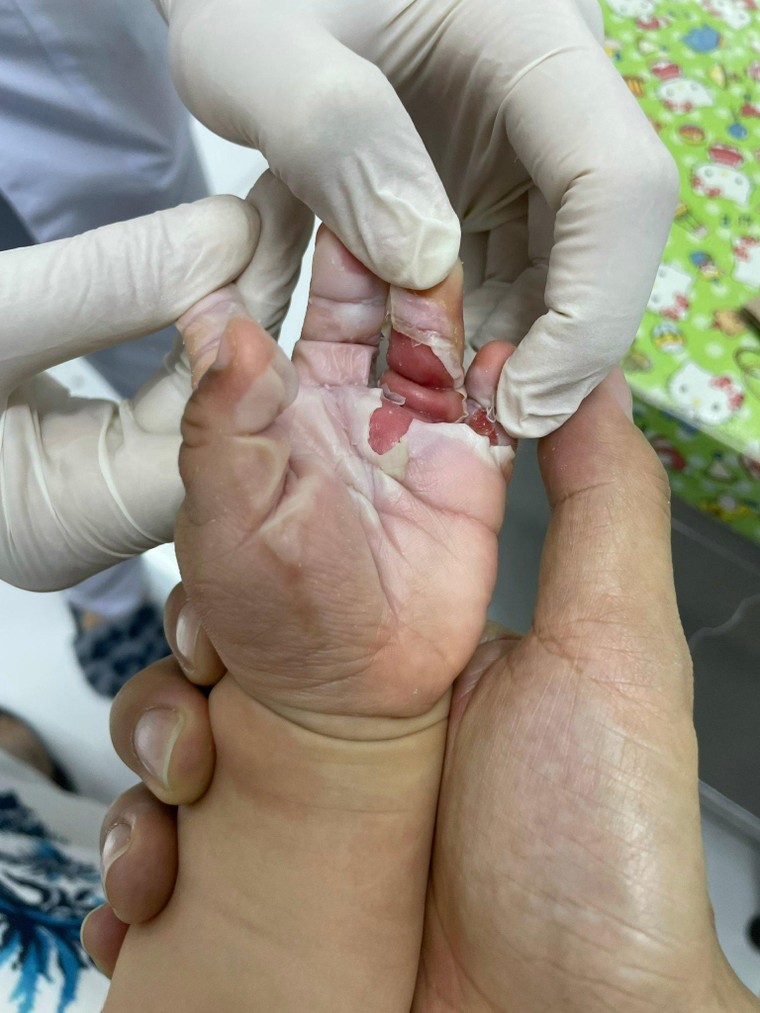 Vụ Bệnh nhân diễn tiến nặng, Bệnh viện FV nói ‘đúng quy trình’: Bệnh nhân kiện tới cùng! ảnh 2