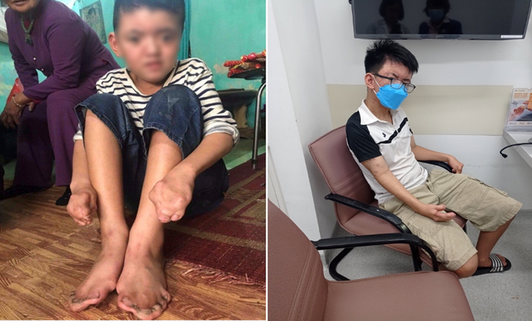 “Phù thủy phẫu thuật bàn tay” trở lại Việt Nam tiếp tục mang phép màu ảnh 1