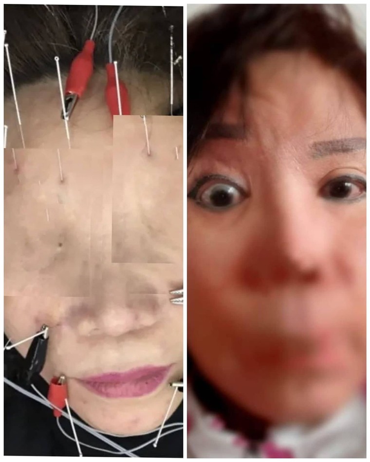 Thẩm mỹ Kangnam: Khi thương hiệu bị mang đánh đổi ảnh 3