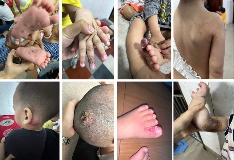 Vụ bạo hành trẻ tại mái ấm Hoa Hồng: Chủ cơ sở không thể vô can! ảnh 1