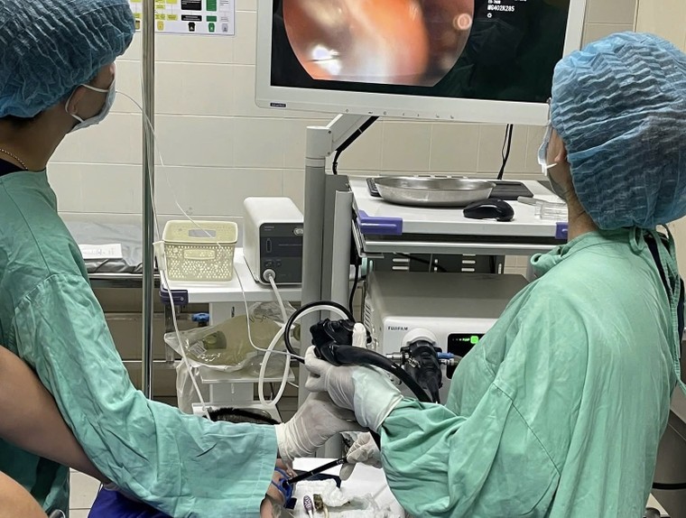 Nội soi cứu người nuốt ba bàn chải đánh răng ảnh 2