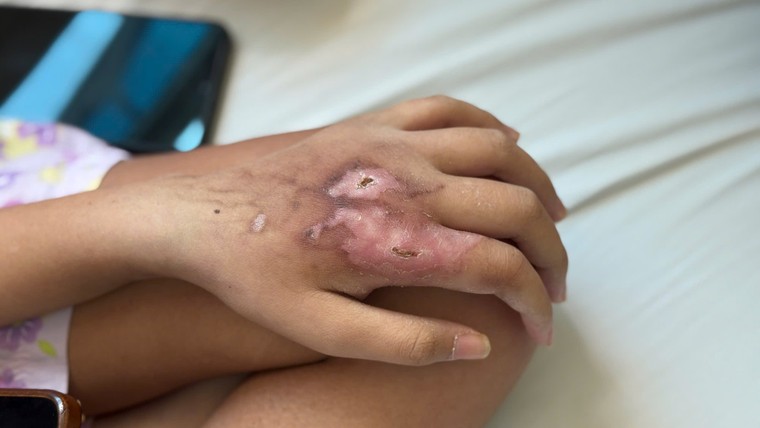 Người trẻ và cuộc chiến không báo trước với ung thư ảnh 2