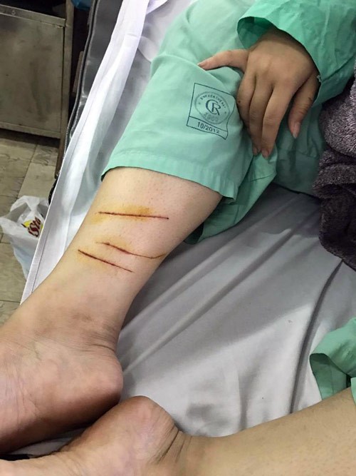 Đang bán trà sữa thiếu nữ bị giang hồ lao vào cắt tai ảnh 1