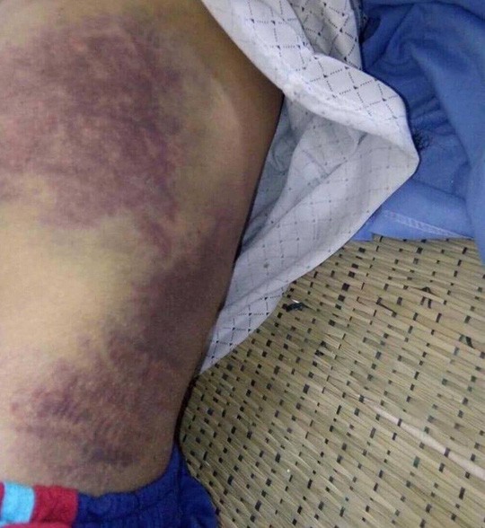 Con trai đánh bố gãy xương sườn, mẻ xương chân và bánh chè ảnh 2