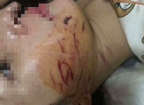 Khởi tố 3 phụ nữ đánh ghen lột đồ, đổ nước mắm vào chủ tiệm spa ở Thanh Hóa ảnh 1