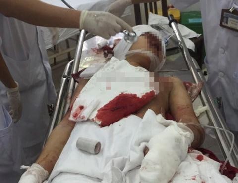 3 người bị Trưởng trạm y tế chém: 'Cháu cứu mẹ cháu' ảnh 1