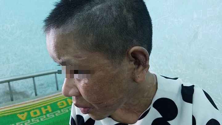 Lộ thêm những đòn tra tấn man rợ của bà chủ mất nhân tính ở Gia Lai ảnh 4