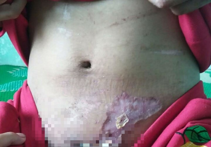 Lộ thêm những đòn tra tấn man rợ của bà chủ mất nhân tính ở Gia Lai ảnh 6