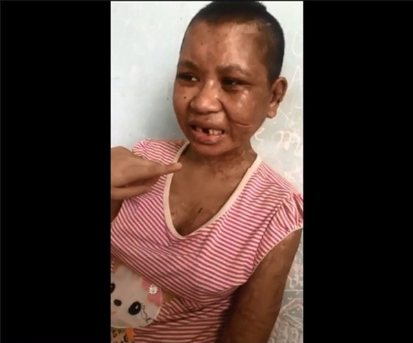 Lộ thêm những đòn tra tấn man rợ của bà chủ mất nhân tính ở Gia Lai ảnh 7