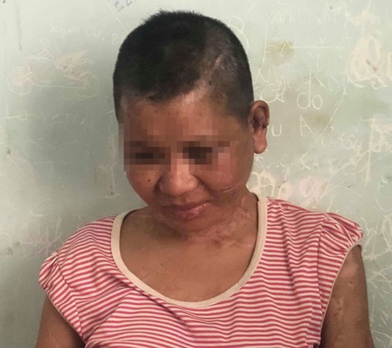 Lộ thêm những đòn tra tấn man rợ của bà chủ mất nhân tính ở Gia Lai ảnh 8