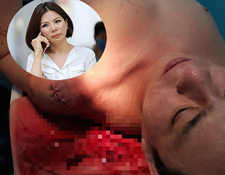 Bất ngờ kế hoạch 'đen' phía sau vụ truy sát bác sĩ Chiêm Quốc Thái ảnh 2