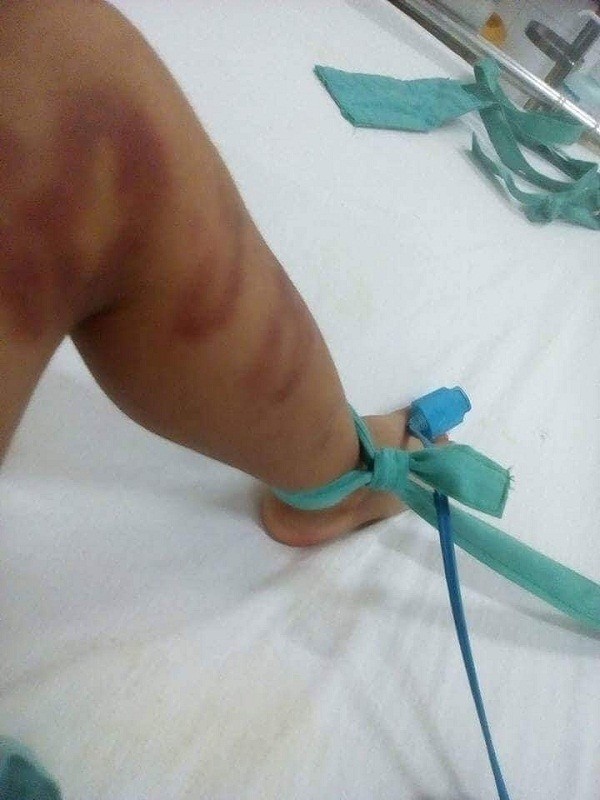 Gã tình nhân trẻ nhẫn tâm, bạo hành dã man con riêng bạn gái đến nhập viện ảnh 1