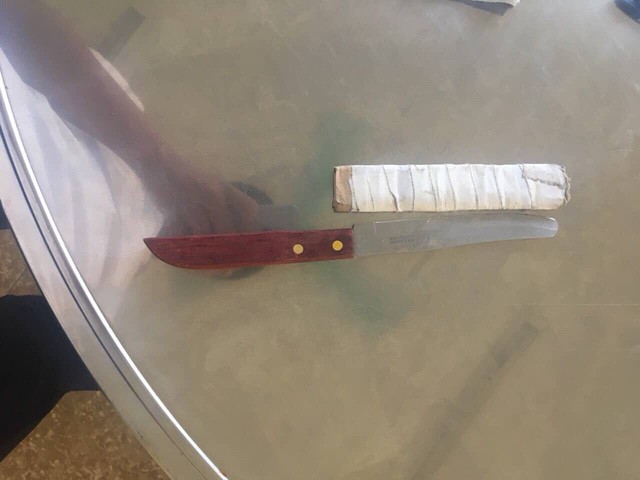 Vụ nữ nhân viên hộ lý bị chồng bạo hành: Đối tượng khai gì với cơ quan công an? ảnh 2