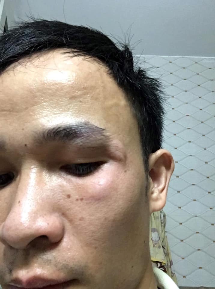 Công an vào cuộc vụ thanh niên đi SH lao trúng bà bầu ảnh 1