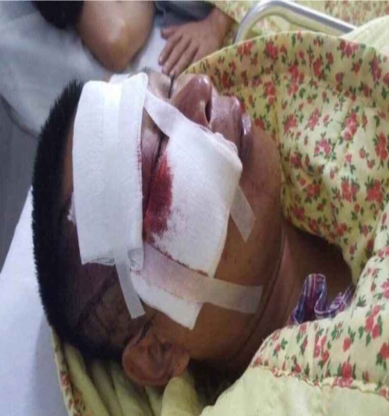 Cư dân Hapulico kêu cứu ảnh 1