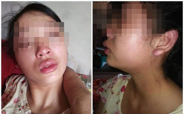 Nghi vấn vợ 16 tuổi đang mang thai bị bạo hành dã man, bị đuổi ra khỏi nhà ảnh 1