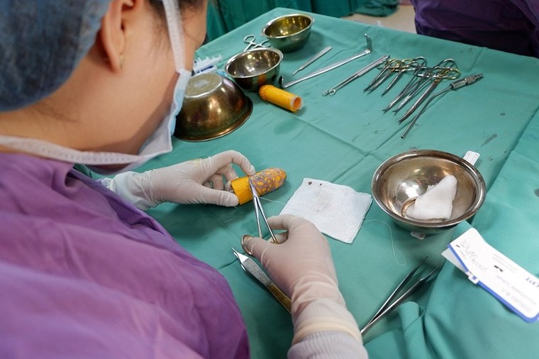 Tạo hình miễn phí cho cô gái trẻ 22 năm không có âm đạo ảnh 1