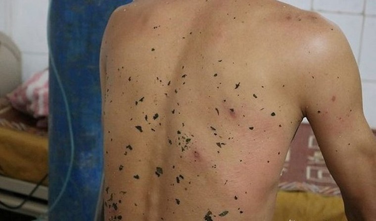 Thanh niên bị ong đốt chết, 10 người kéo lên 'giải vía' tiếp tục bị thương ảnh 1