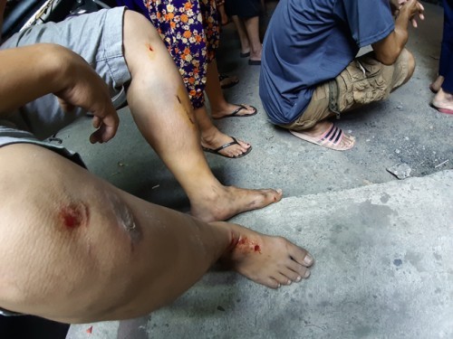 Tài xế ôtô 'điên' lấy áo che biển số xe sau khi đâm hàng loạt xe máy ảnh 1