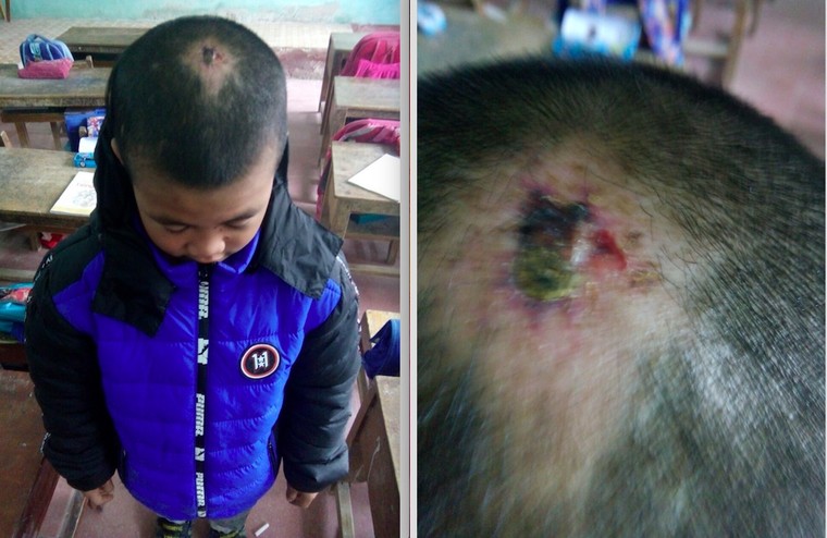 Vụ em bé 10 tuổi bị bạo hành ở Thanh Hoá: Ni cô lên tiếng phân trần ảnh 1