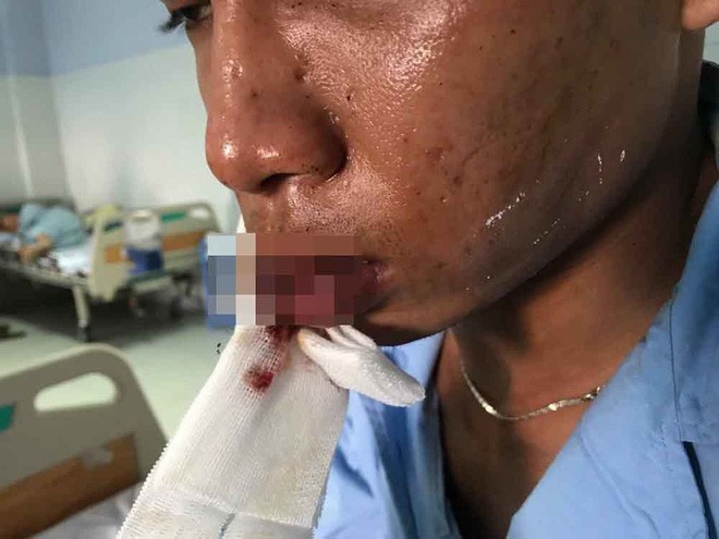 Băng nhóm giang hồ nghi vấn xông vào quán cà phê đâm chém nhân viên để đòi tiền bảo kê đã sa lưới ảnh 1