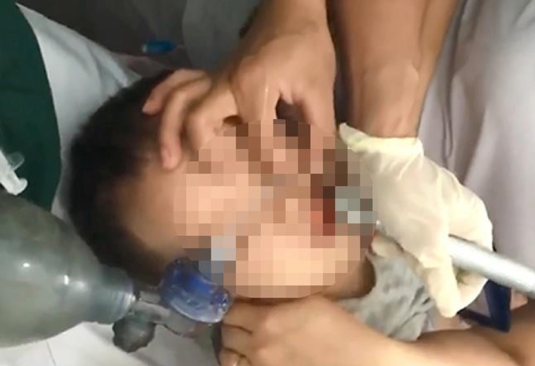 Bé trai 2 tuổi suýt chết vì hóc thạch rau câu ảnh 1
