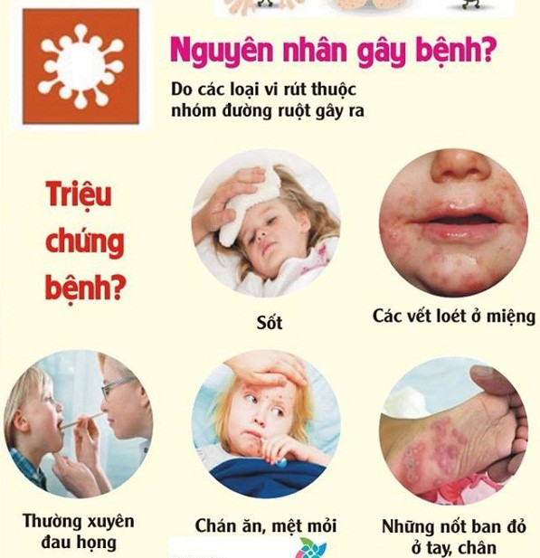 Chuyên gia chỉ cách nhận diện bệnh tay chân miệng ở trẻ em qua các giai đoạn ảnh 2