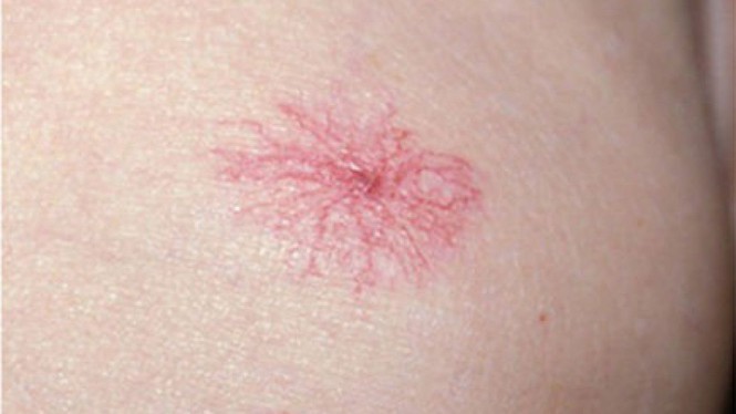 Dấu hiệu trên mặt cảnh báo bệnh nguy hiểm, đừng bỏ qua mà 'hối không kịp' ảnh 2