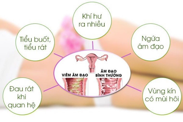Nguyên nhân có thể gây vô sinh, hiếm muộn ở phụ nữ ảnh 2