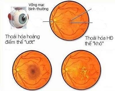 Cúc hoa vàng chữa bệnh mắt ảnh 1