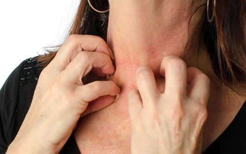 Mùi thơm cũng gây... ngộ độc ảnh 3