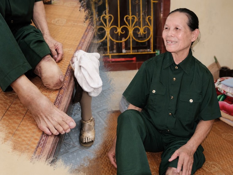 Hai chiếc chân giả, một nhịp sống không ngơi ảnh 2