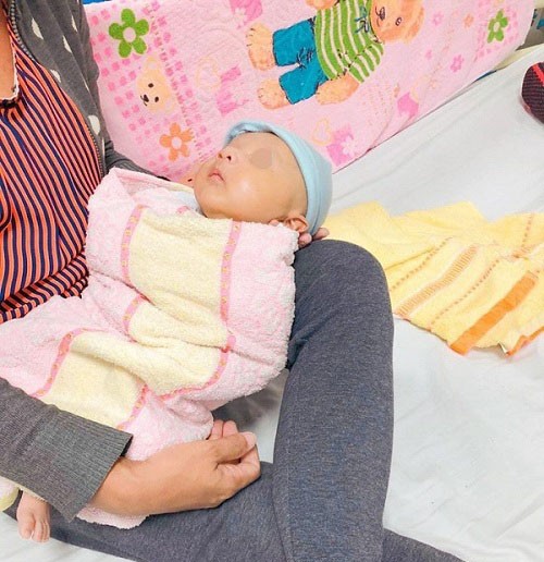 Bé sơ sinh bị ứ độc NH3 được cứu sống sau hai ngày lọc máu liên tục ảnh 1