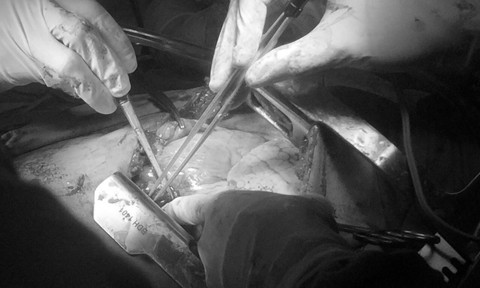 Bác sỹ ‘chạy đua’ cứu người đàn ông dùng kéo tự đâm 5 nhát thủng tim ảnh 1