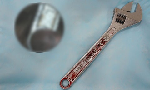 Thanh niên19 tuổi nhập viện cấp cứu vì thủ dâm bằng... mỏ lết ảnh 1