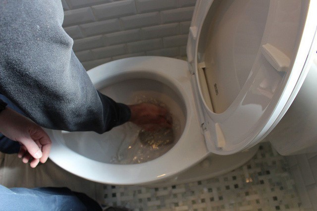 Người đàn ông bị bỏng nặng do dùng bột thông cống ảnh 1