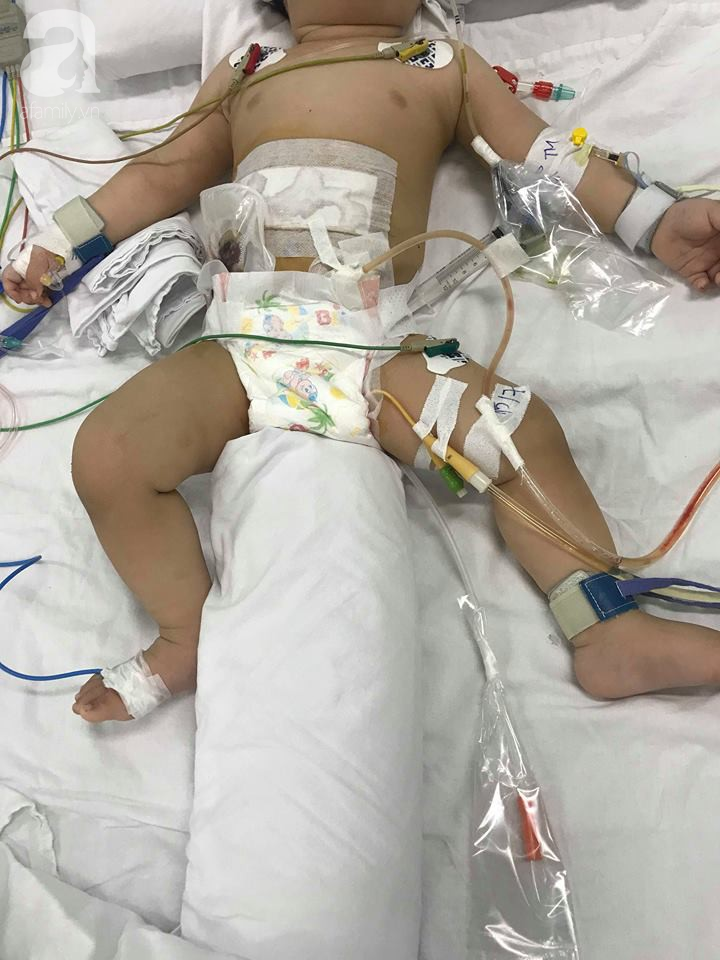 Bị mẹ đâm nhiều nhát vào bụng, bé trai 11 tháng tuổi lâm vào nguy kịch ảnh 1