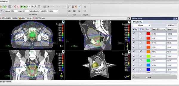 Điều trị ung thư bằng trí tuệ nhân tạo: Cứ tin theo là chết ảnh 2