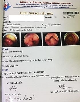 Người phụ nữ bị sa toàn bộ âm đạo vì vội đi làm sau sinh ảnh 1