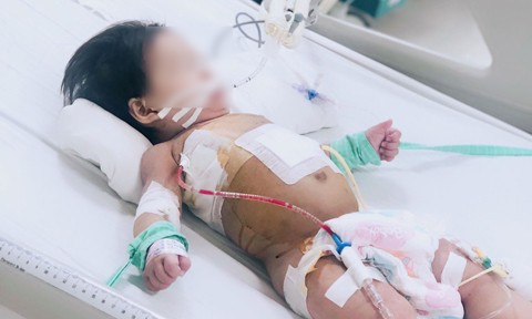 Bé 10 tháng nguy kịch vì mang 2 loại siêu vi khuẩn kháng tất cả kháng sinh ảnh 1